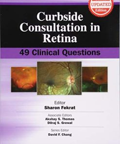 Curbside Consultation in Retina: 49 Clinical Questions, 2nd Edition (Curbside Consultation in Ophthalmology) (EPUB)