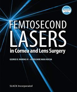 Femtosecond Lasers in Cornea and Lens Surgery (PDF)