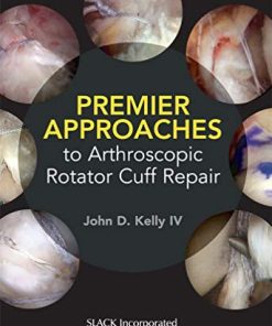 Premier Approaches to Arthroscopic Rotator Cuff Repair (PDF)