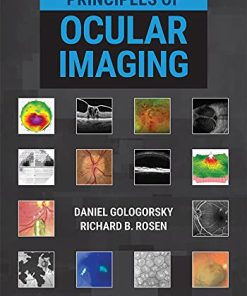 Principles of Ocular Imaging (PDF)