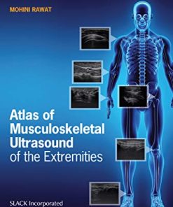 Atlas of Musculoskeletal Ultrasound of the Extremities (PDF)