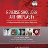 Reverse Shoulder Arthroplasty: A Comprehensive Case-Based Approach (PDF)