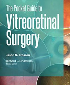 The Pocket Guide to Vitreoretinal Surgery (Pocket Guides) (PDF)