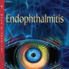 Endophthalmitis (PDF)