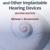 Cochlear Implants and Other Implantable Hearing Devices, 2nd edition (HQ Image PDF)