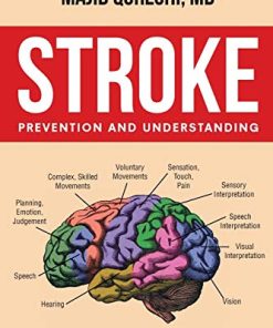 Stroke: Prevention and Understanding (Epub)