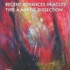 Recent Advances in Acute Type a Aortic Dissection (PDF) Recent Advances in Acute Type a Aortic Dissection (PDF)