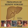 Principles of Hepatic Surgery (PDF)