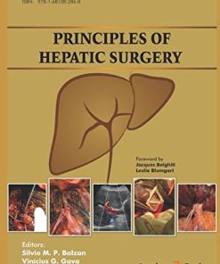 Principles of Hepatic Surgery (PDF)