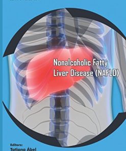 Nonalcoholic Fatty Liver Disease (NAFLD) (PDF)