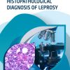 Histopathological Diagnosis Of Leprosy (PDF)