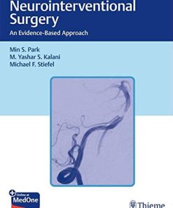 Neurointerventional Surgery: An Evidence-based Approach (PDF)