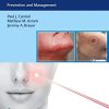 Complications in Minimally Invasive Facial Rejuvenation: Prevention and Management (PDF Book & Videos)