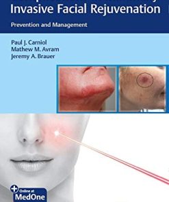 Complications in Minimally Invasive Facial Rejuvenation: Prevention and Management (PDF Book & Videos)