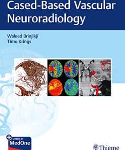 Imaging in Neurovascular Disease: A Case-Based Approach (PDF)