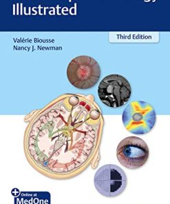 Neuro-Ophthalmology Illustrated, 3rd Edition (PDF)