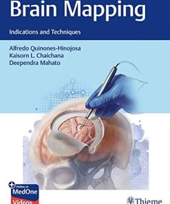 Brain Mapping: Indications and Techniques (PDF)