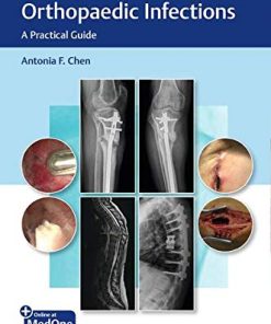 Management of Orthopaedic Infections: A Practical Guide (PDF)