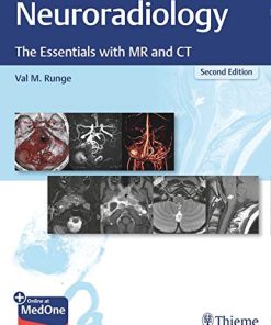 Neuroradiology: The Essentials with MR and CT, 2ed (PDF)