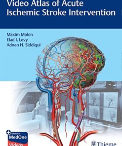 Video Atlas of Acute Ischemic Stroke Intervention (PDF Book+Videos)