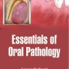 Essentials Of Oral Pathology (PDF) Essentials Of Oral Pathology (PDF)