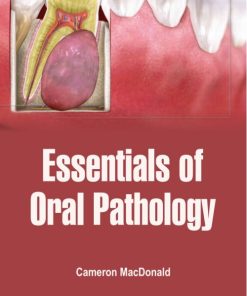 Essentials Of Oral Pathology (PDF)