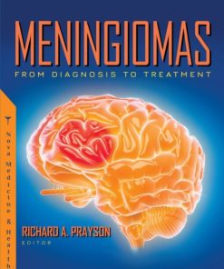 Meningiomas: From Diagnosis to Treatment (PDF)