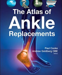 The Atlas of Ankle Replacements (PDF)