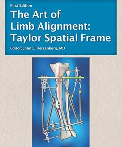 The Art of Limb Alignment: Taylor Spatial Frame (PDF)