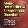 Atopic Dermatitis and Eczematous Disorders