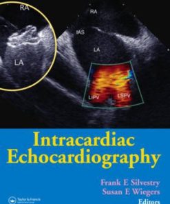 Intracardiac Echocardiography (PDF)