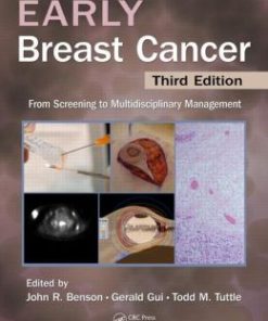 Early Breast Cancer: From Screening to Multidisciplinary Management, Third Edition