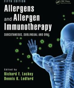 Allergens and Allergen Immunotherapy: Subcutaneous, Sublingual and Oral, 5th Edition