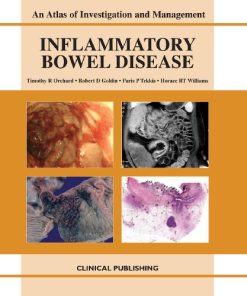 Inflammatory Bowel Disease: An Atlas of Investigation and Management (PDF)