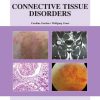 Connective Tissue Disorders: An Atlas of Investigation and Management (PDF)