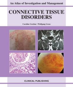 Connective Tissue Disorders: An Atlas of Investigation and Management (PDF)