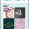 Breast Cancer: Visual Guide for Clinicians (PDF)