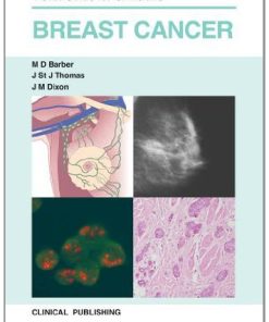 Breast Cancer: Visual Guide for Clinicians (PDF)