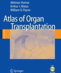 Atlas of Organ Transplantation (PDF)