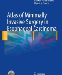 Atlas of Minimally Invasive Surgery in Esophageal Carcinoma (PDF)