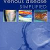 Venous Disease Simplified (PDF) Venous Disease Simplified (PDF)