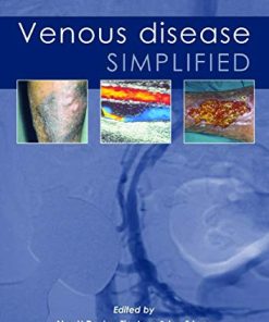 Venous Disease Simplified (PDF)