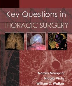 Key Questions in Thoracic Surgery (EPUB)