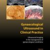 Gynaecological Ultrasound in Clinical Practice: Ultrasound Imaging in the Management of Gynaecological Conditions