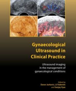 Gynaecological Ultrasound in Clinical Practice: Ultrasound Imaging in the Management of Gynaecological Conditions