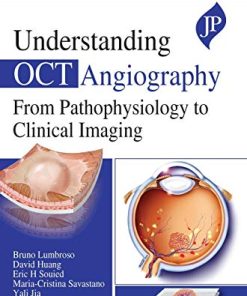 Understanding OCT Angiography from Pathophysiology to Clinical Imaging (Converted PDF)