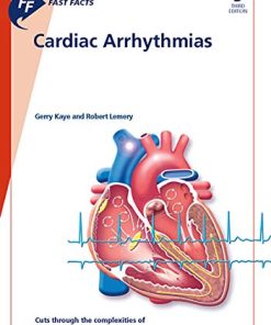 Fast Facts: Cardiac Arrhythmias (PDF)