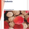 Fast Facts: Leukemia: From initial gene mutation to survivorship support (PDF)