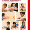 SINDA Standardized Infant NeuroDevelopmental Assessment: An Instrument for Early Detection of Neurodevelopmental Disorders (Mac Keith Press Practical Guides) (PDF)