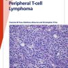 Fast Facts: Peripheral T-cell Lymphoma: Unraveling the complexities of diagnosis and management (PDF)